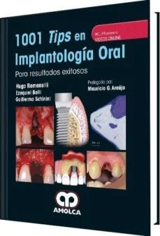 1001 tips en implantologia oral para resultados exitosos + videos online (Hugo Romanelli, Ezequiel Bolli Y Guillermo Schinini)